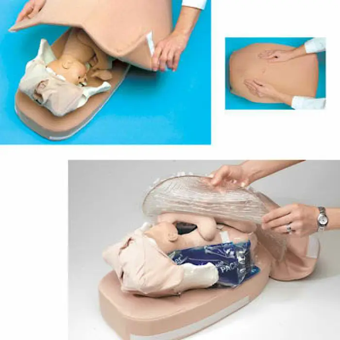 Abdominálny model na prehmatanie