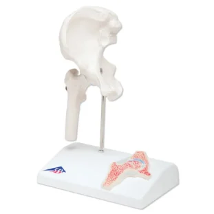 Mini model bedrového kĺbu s prierezom