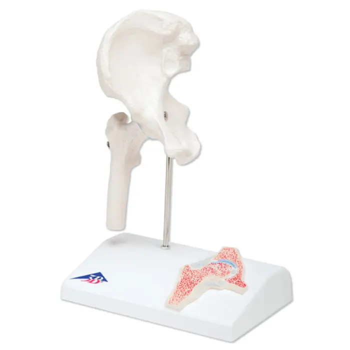 Mini model bedrového kĺbu s prierezom
