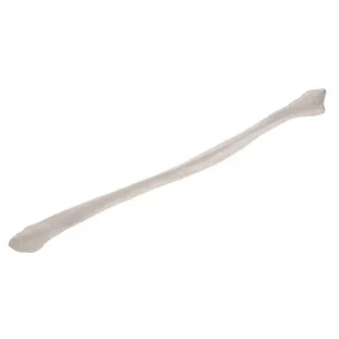 Ihlica (Fibula)