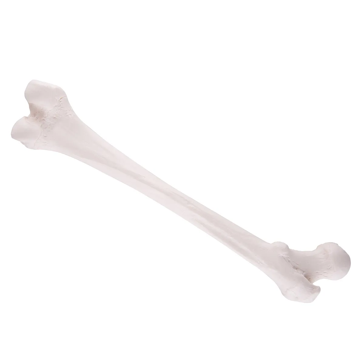 Stehenná kosť (Femur)