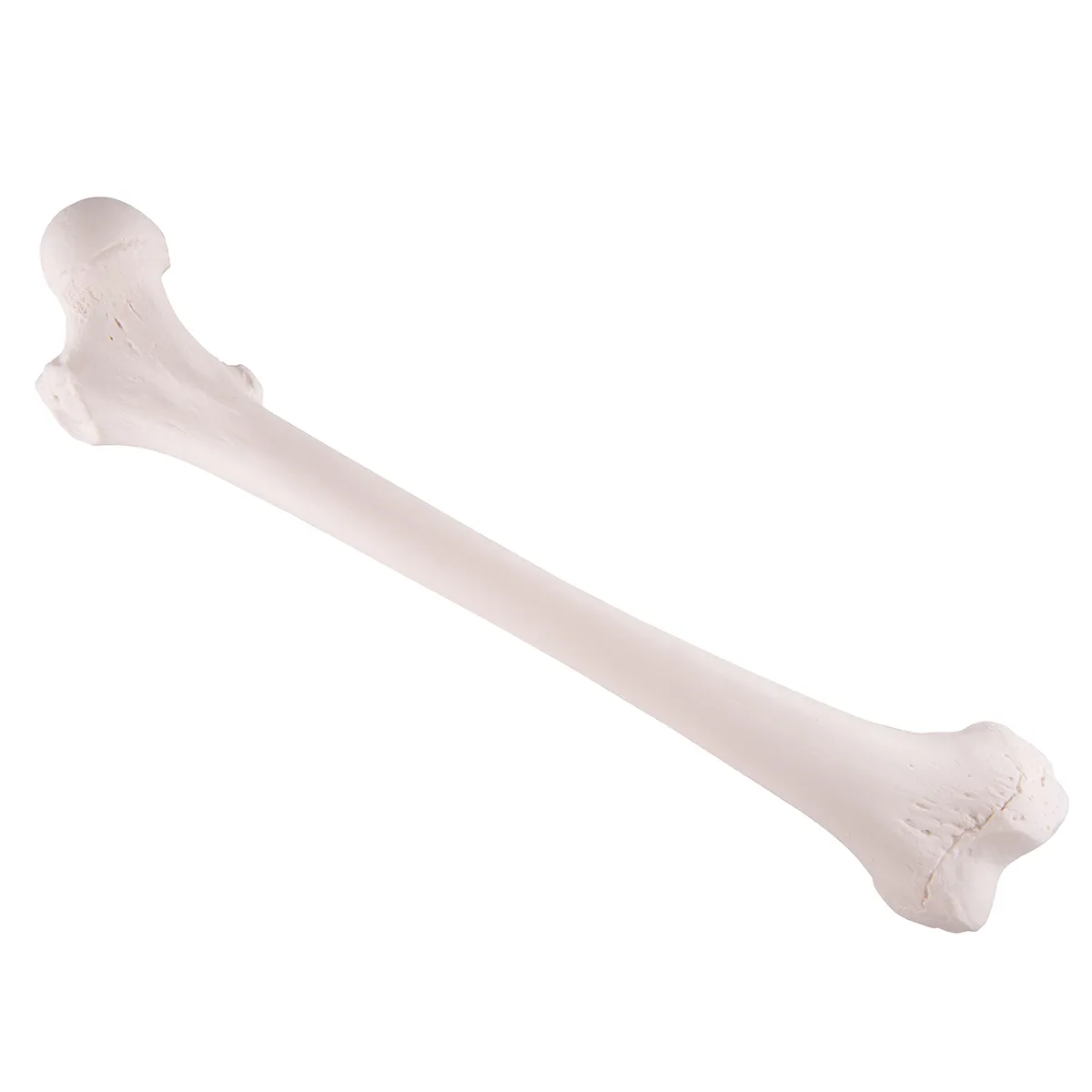 Stehenná kosť (Femur) – Obrázok 2