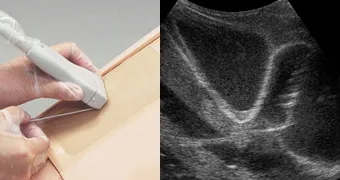 Simulátor pre uskutočňovanie perikardiocentézy a torakocentézy s pomocou ultrazvuku – Obrázok 2