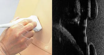 Simulátor pre uskutočňovanie perikardiocentézy a torakocentézy s pomocou ultrazvuku – Obrázok 3