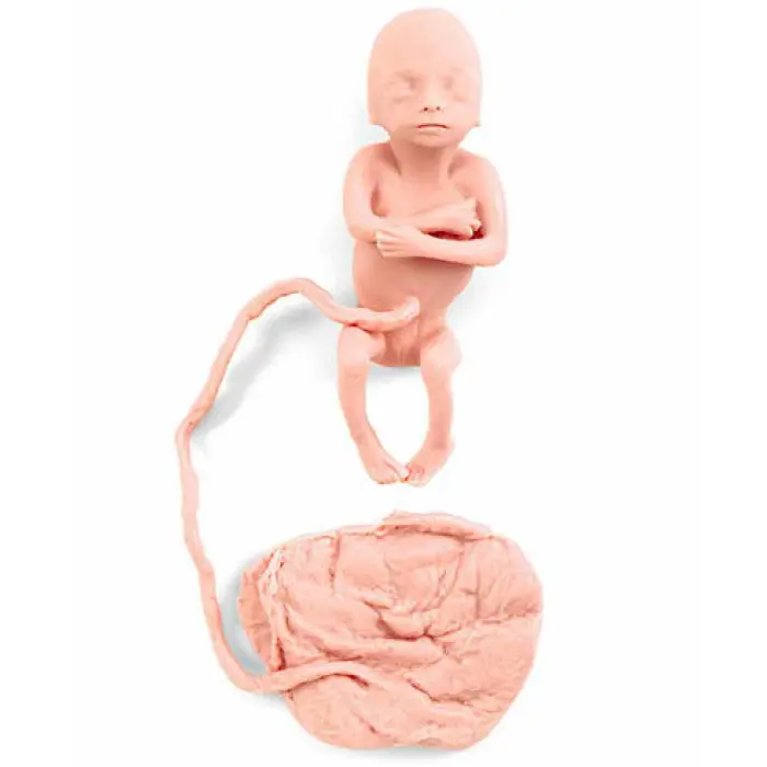 Replika ľudského plodu
