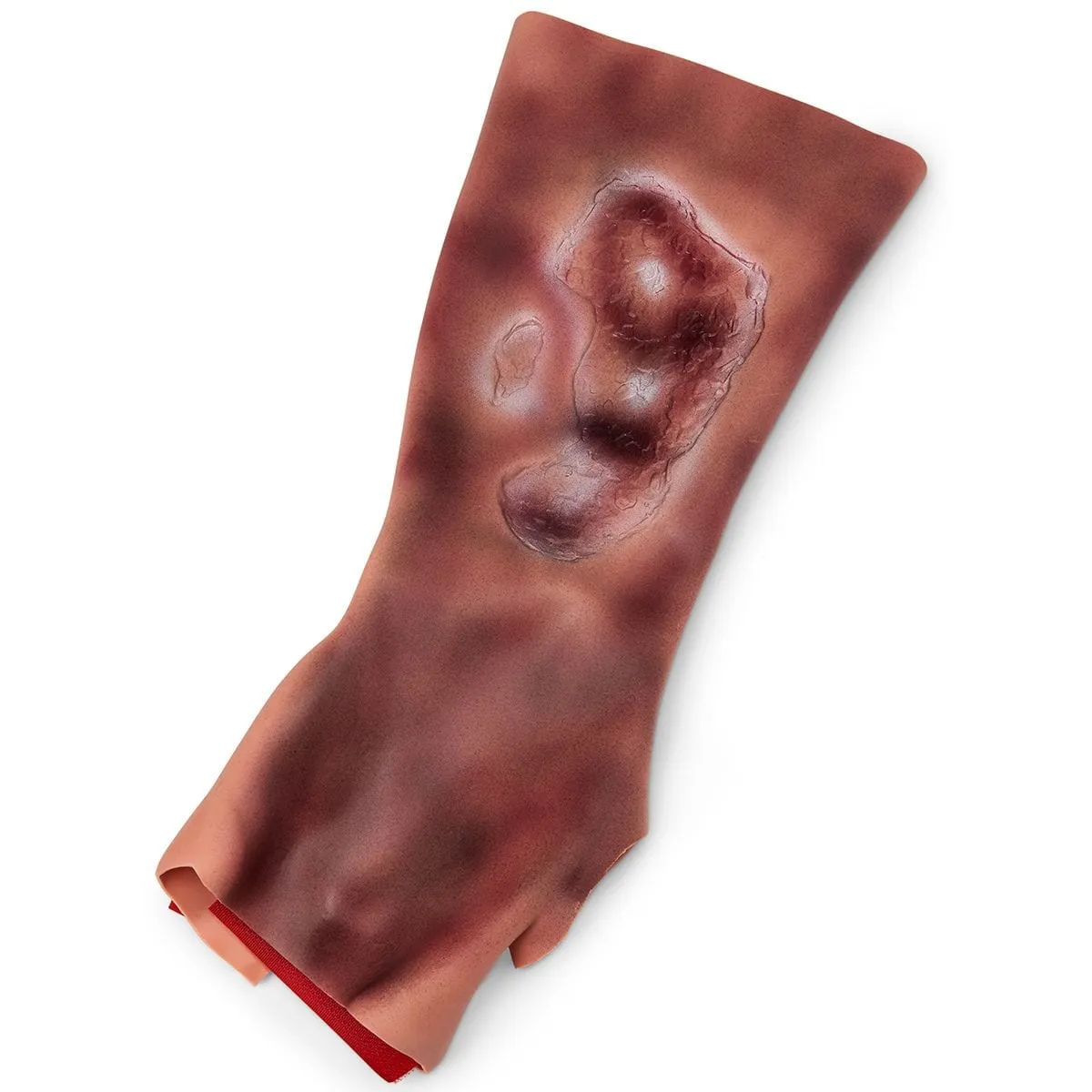 Úrazová odliatková sada – Obrázok 4